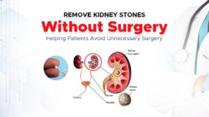 Kidney Stone Treatment Without Surgery | A Complete Guide by Dr. Muhammad Ijaz